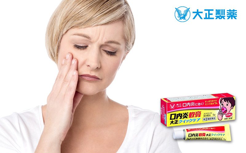 구내염연고 포스팅